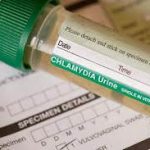 Chlamydia